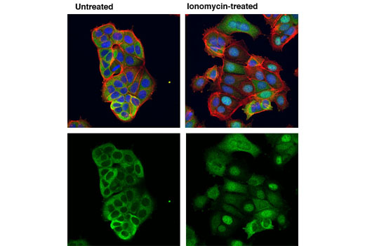 Immunofluorescence Image 1: NFAT1 (D43B1) XP® Rabbit mAb