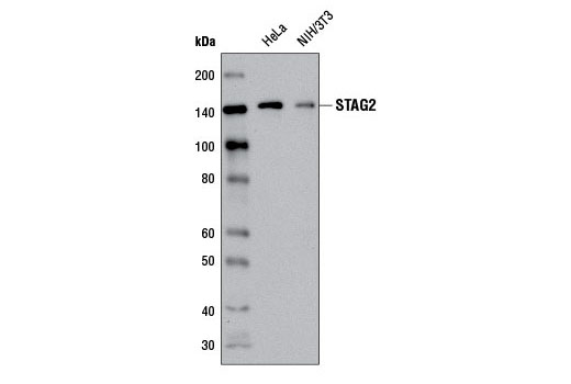 Western Blotting Image 1: STAG2 (D25A4) XP® Rabbit mAb