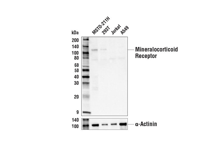 Western Blotting Image 1: Mineralocorticoid Receptor (E9W1M) Rabbit mAb