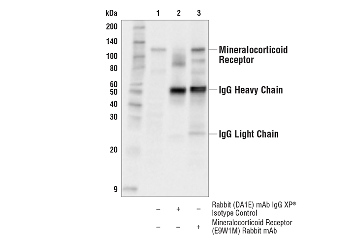 Immunoprecipitation Image 1: Mineralocorticoid Receptor (E9W1M) Rabbit mAb