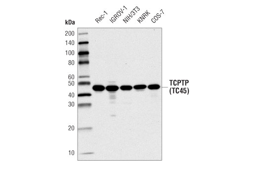 Western Blotting Image 1: TCPTP (TC45) (D7T7D) Rabbit mAb