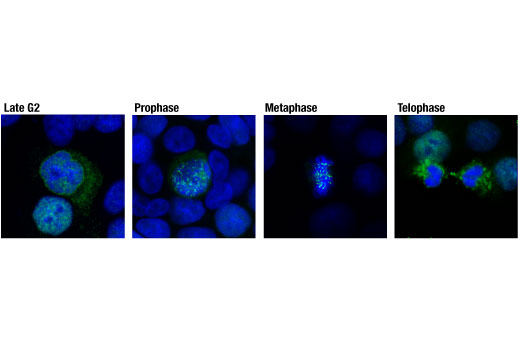 Immunofluorescence Image 1: CENP-F (D6X4L) Rabbit mAb