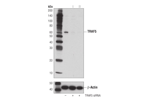  Image 1: SignalSilence® TRAF5 siRNA II