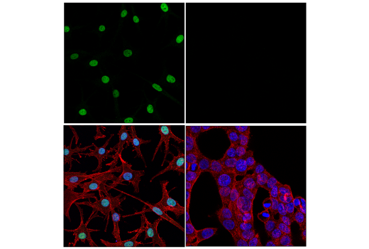Immunofluorescence Image 1: MITF (D5) Mouse mAb