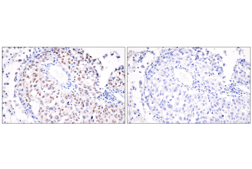 Immunohistochemistry Image 1: MITF (D5) Mouse mAb