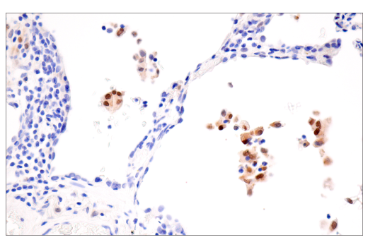 Immunohistochemistry Image 3: MITF (D5) Mouse mAb