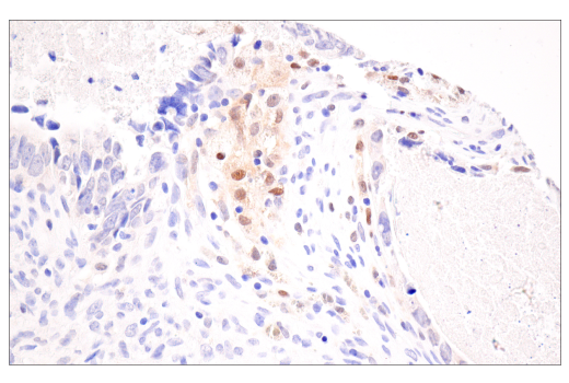 Immunohistochemistry Image 4: MITF (D5) Mouse mAb