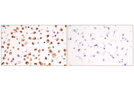 Immunohistochemistry Image 5: MITF (D5) Mouse mAb