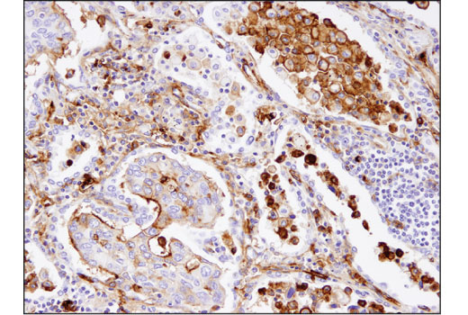 Immunohistochemistry Image 2: CD13/APN (D6V1W) Rabbit mAb (BSA and Azide Free)