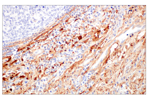 Immunohistochemistry Image 5: COL14A1 (E5W8S) Rabbit mAb