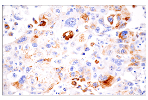 Immunohistochemistry Image 4: CPS1/Hep Par-1 (E9I9U) Rabbit mAb
