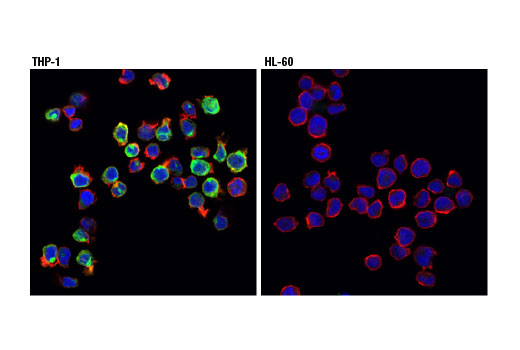Immunofluorescence Image 1: TREM2 (D8I4C) Rabbit mAb (BSA and Azide Free)