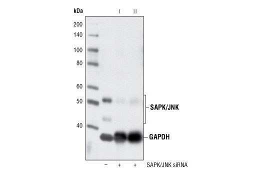  Image 1: SignalSilence® SAPK/JNK siRNA II
