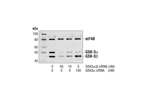  Image 2: SignalSilence® GSK-3α siRNA I