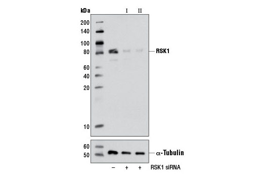  Image 1: SignalSilence® RSK1 siRNA II