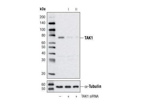  Image 1: SignalSilence® TAK1 siRNA II