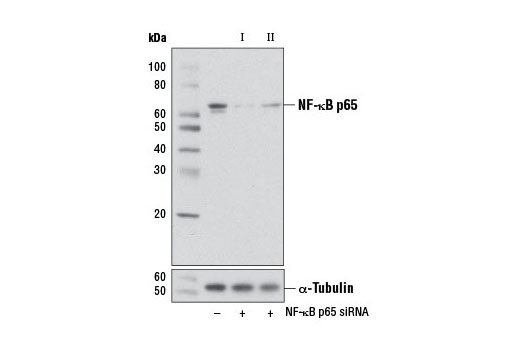  Image 1: SignalSilence® NF-κB p65 siRNA II (Mouse Specific)