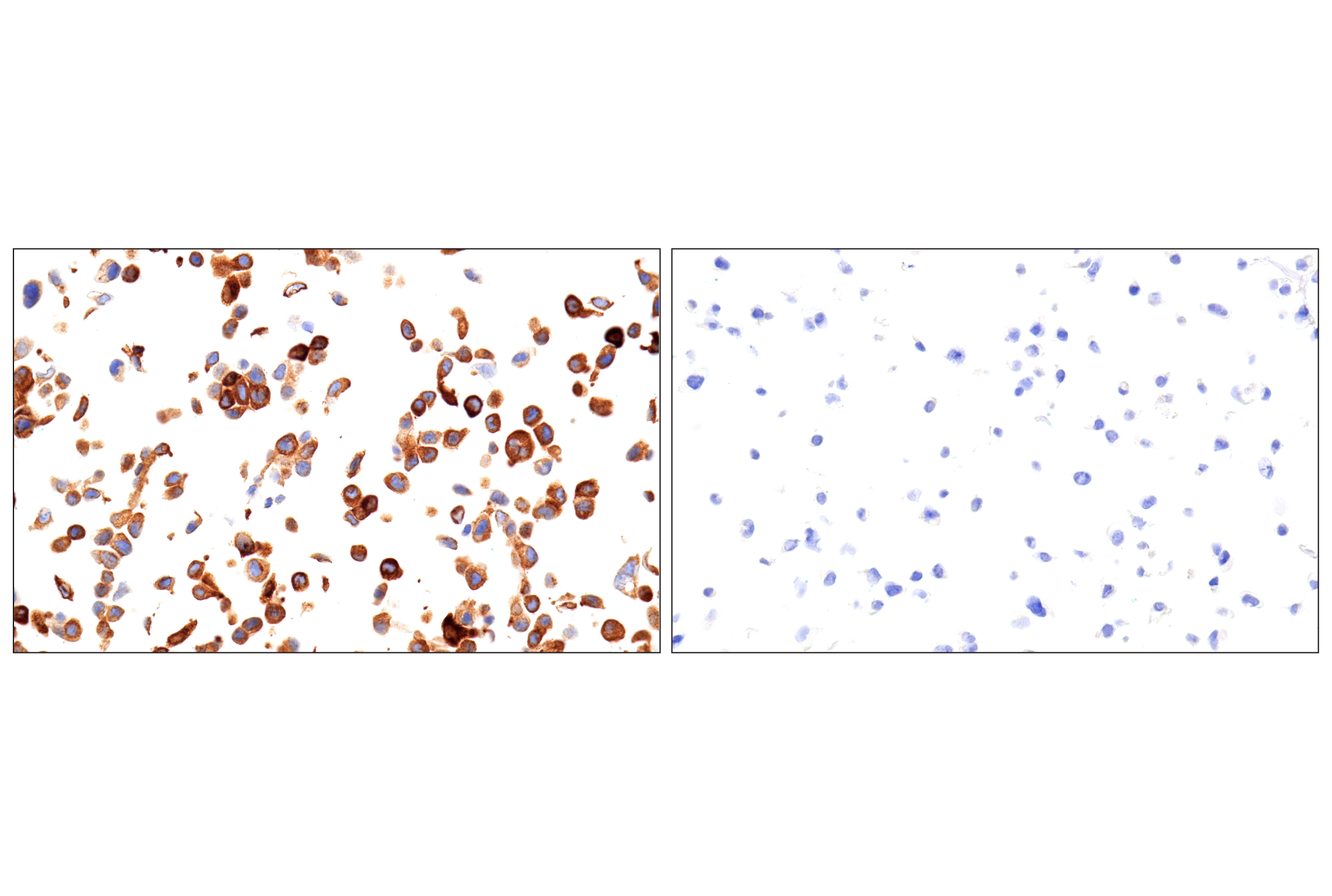 Immunohistochemistry Image 2: ROS1 (D4D6®) Rabbit mAb (Autostainer Formulated)