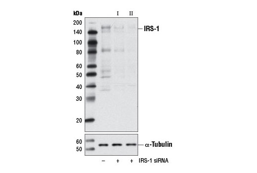  Image 1: SignalSilence® IRS-1 siRNA I (Mouse Specific)