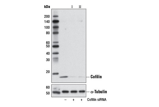  Image 1: SignalSilence® Cofilin siRNA I (Mouse Specific)