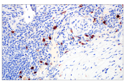 Immunohistochemistry Image 2: Tryptase (10D11) Mouse mAb