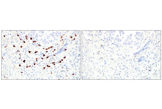 Immunohistochemistry Image 14: Tryptase (10D11) Mouse mAb
