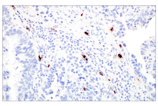 Immunohistochemistry Image 3: Tryptase (10D11) Mouse mAb