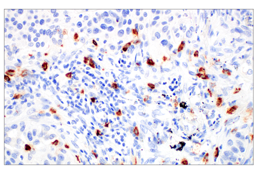 Immunohistochemistry Image 1: Tryptase (10D11) Mouse mAb
