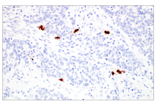 Immunohistochemistry Image 4: Tryptase (10D11) Mouse mAb