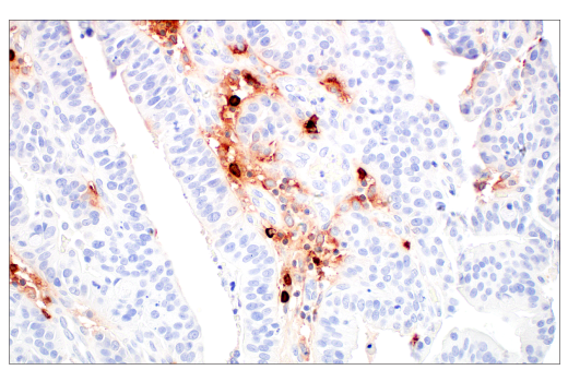 Immunohistochemistry Image 5: Tryptase (10D11) Mouse mAb