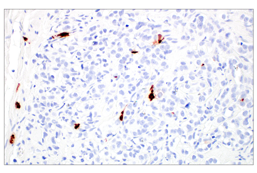 Immunohistochemistry Image 7: Tryptase (10D11) Mouse mAb