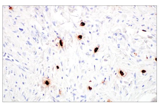 Immunohistochemistry Image 8: Tryptase (10D11) Mouse mAb