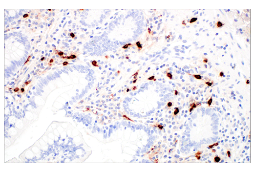 Immunohistochemistry Image 11: Tryptase (10D11) Mouse mAb