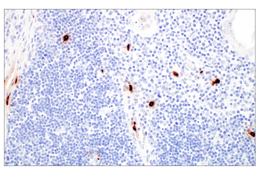 Immunohistochemistry Image 12: Tryptase (10D11) Mouse mAb
