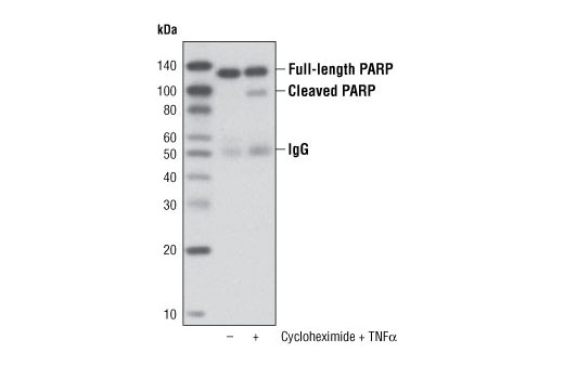 Immunoprecipitation Image 1: PARP (46D11) Rabbit mAb (Sepharose® Bead Conjugate)