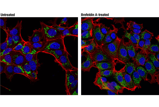 Immunofluorescence Image 1: RCAS1 (D8K2E) Mouse mAb