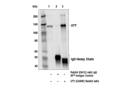 Immunoprecipitation Image 1: UTY (E4X6V) Rabbit mAb