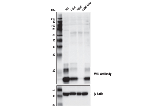 Western Blotting Image 1: VHL Antibody