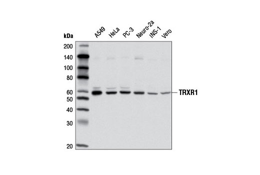 Western Blotting Image 1: TRXR1 Antibody