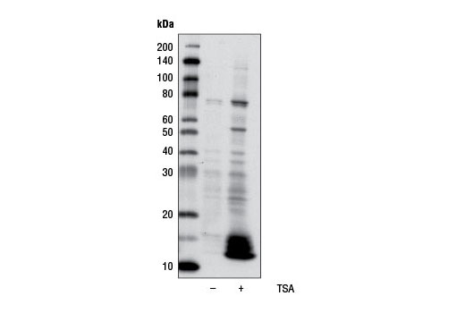 Western Blotting Image 1: Acetylated-Lysine (Ac-K-100) MultiMab® Rabbit mAb mix (HRP Conjugate)