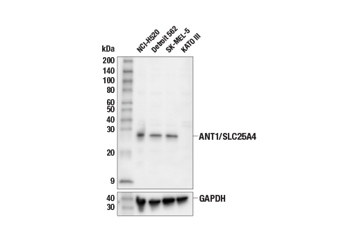 Western Blotting Image 1: ANT1/SLC25A4 Antibody