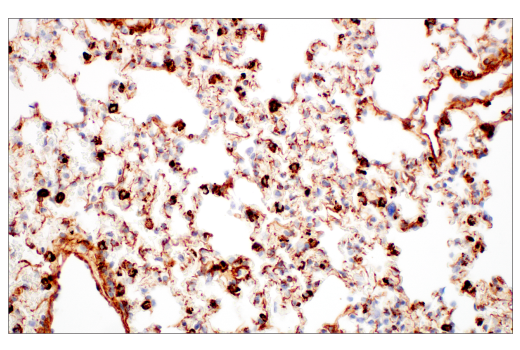 Immunohistochemistry Image 11: EphA2 (D4A2) XP® Rabbit mAb