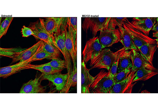Immunofluorescence Image 1: FXR2 (D85D6) Rabbit mAb