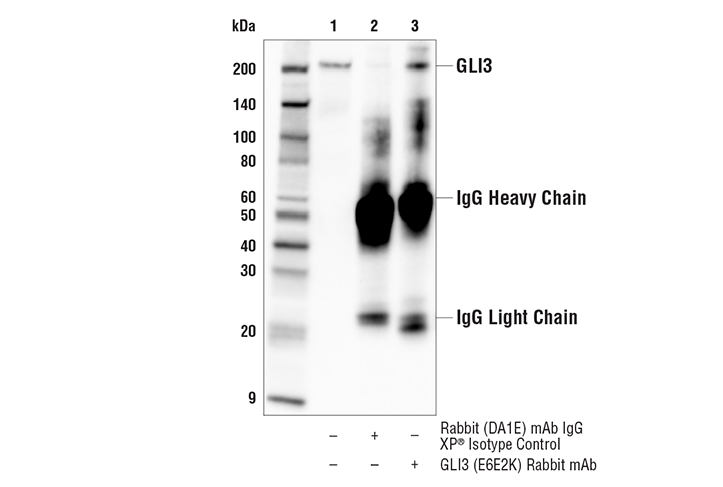 Immunoprecipitation Image 1: GLI3 (E6E2K) Rabbit mAb