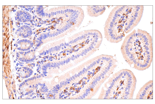 Immunohistochemistry Image 9: Cox2 (D5H5) XP® Rabbit mAb (BSA and Azide Free)