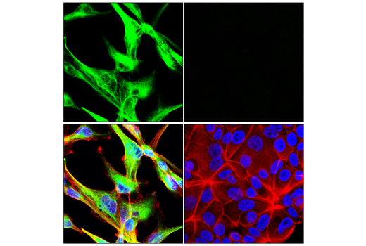 Immunofluorescence Image 1: Nestin (E4O9E) XP® Rabbit mAb