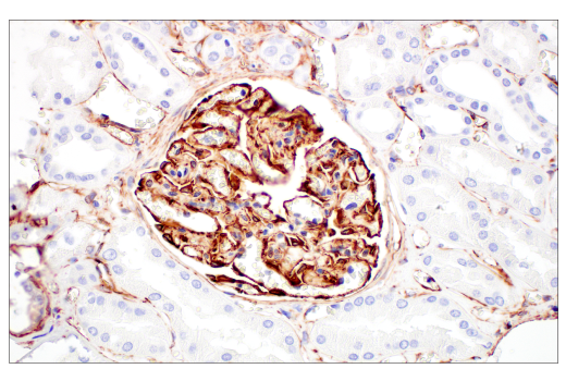 Immunohistochemistry Image 7: Nestin (E4O9E) XP® Rabbit mAb