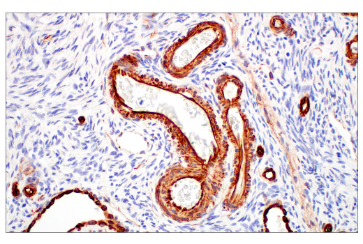 Immunohistochemistry Image 8: Nestin (E4O9E) XP® Rabbit mAb