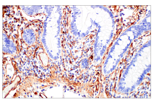 Immunohistochemistry Image 10: Nestin (E4O9E) XP® Rabbit mAb
