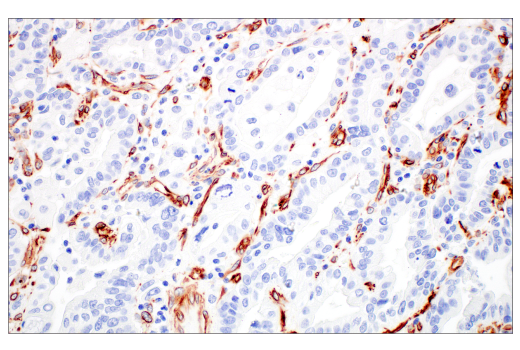 Immunohistochemistry Image 1: Nestin (E4O9E) XP® Rabbit mAb